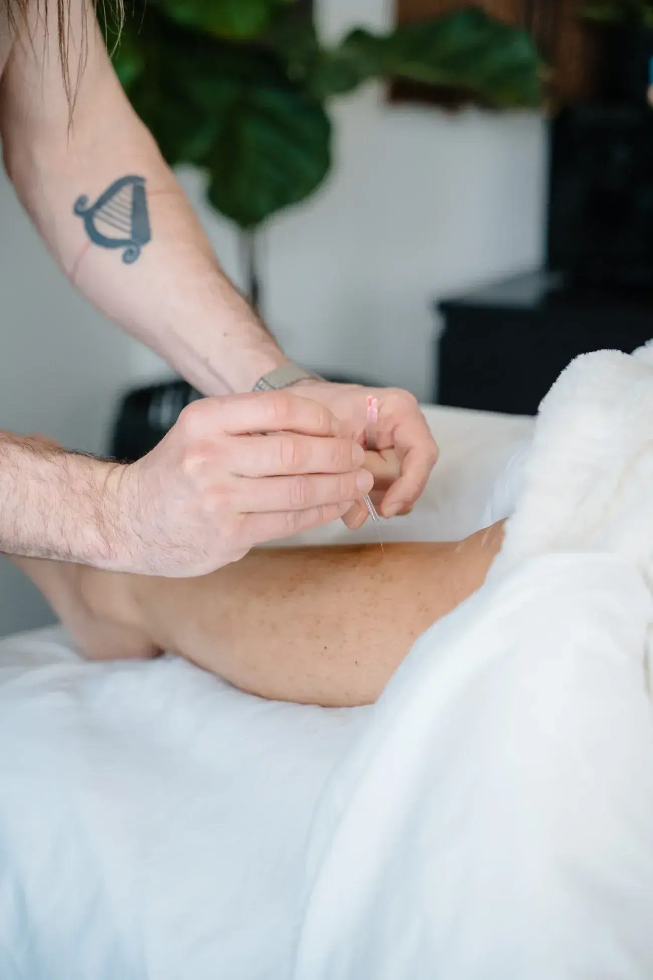 Dr. Will Tanner’s hands placing a needle during an acupuncture treatment